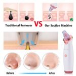 Blackhead Instrument Electric Suction Facial Washing Instrument Beauty Acne Cleaning Blackhead Suction Instrument - Image 8